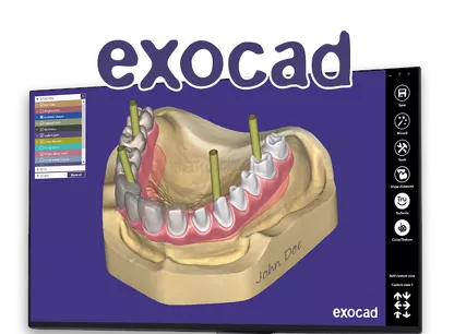 CAD-CAM